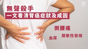 腎癌症狀及成因