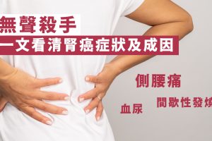 腎癌症狀及成因