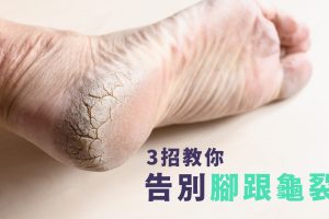 3招教你告別腳跟龜裂