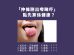 不同顏色舌頭對身體的影響
